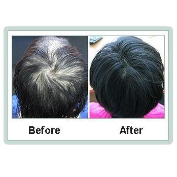 Ashley and Martin Medical Hair Centres - Ashley and Martin Medical Hair Centres