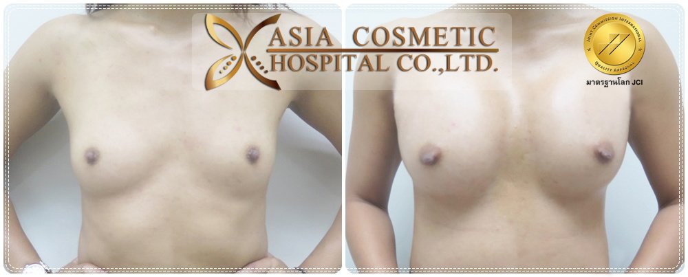Asia Cosmetic Hospital - Asia Cosmetic Hospital