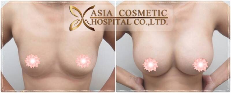 Asia Cosmetic Hospital - Asia Cosmetic Hospital