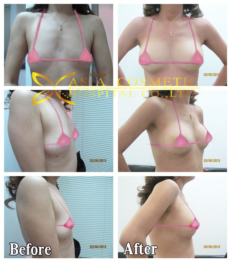 Asia Cosmetic Hospital - Asia Cosmetic Hospital