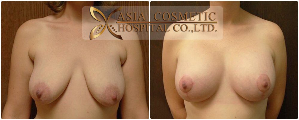 Asia Cosmetic Hospital - Asia Cosmetic Hospital