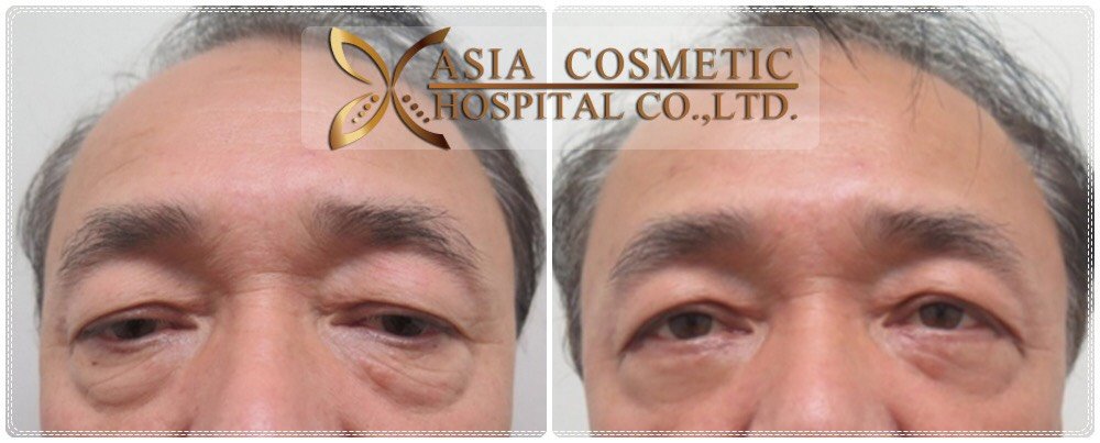 Asia Cosmetic Hospital - Asia Cosmetic Hospital