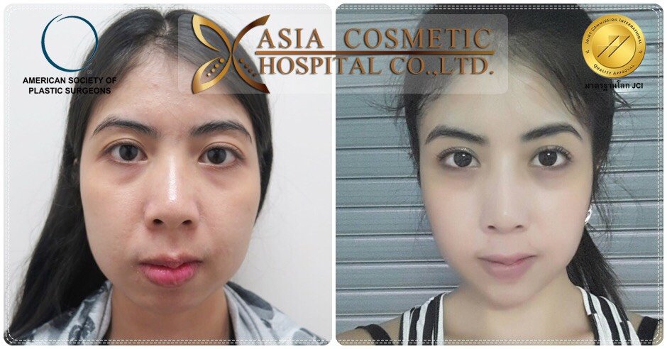 Asia Cosmetic Hospital - Asia Cosmetic Hospital