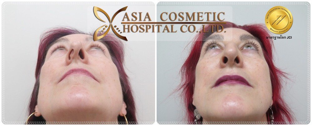 Asia Cosmetic Hospital - Asia Cosmetic Hospital