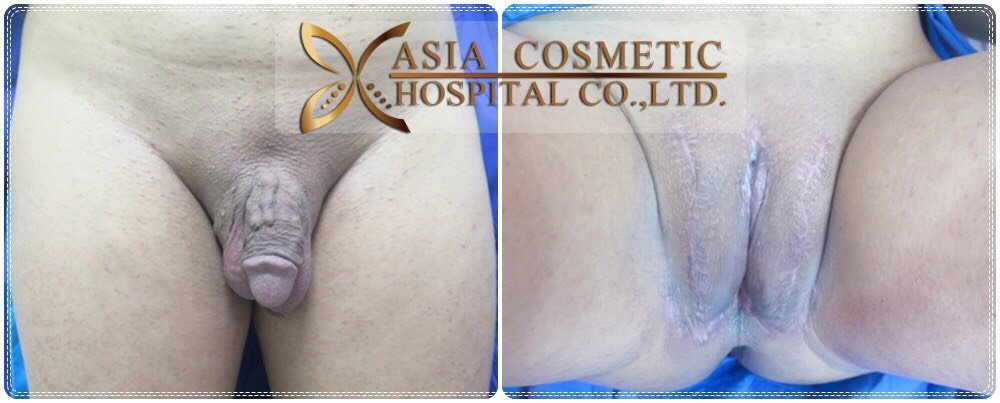 Asia Cosmetic Hospital - Asia Cosmetic Hospital