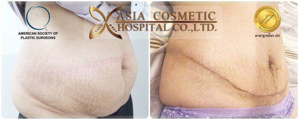 Asia Cosmetic Hospital - Asia Cosmetic Hospital