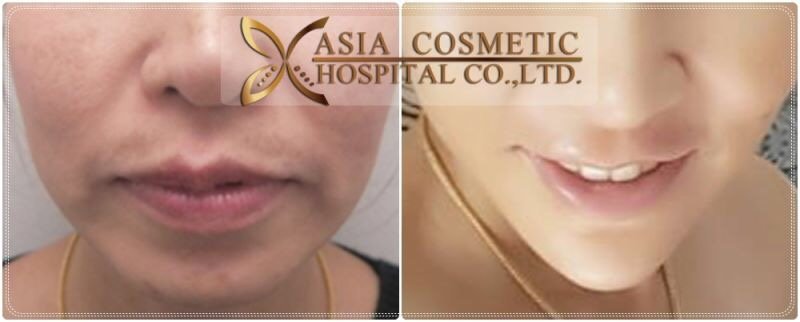 Asia Cosmetic Hospital - Asia Cosmetic Hospital