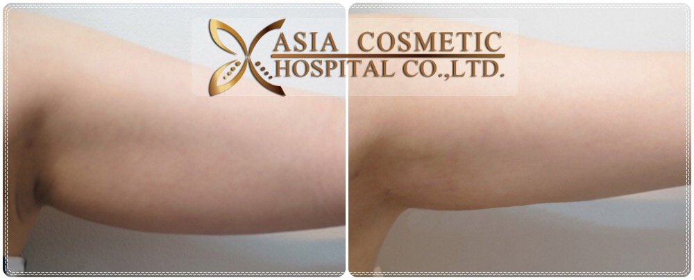 Asia Cosmetic Hospital - Asia Cosmetic Hospital
