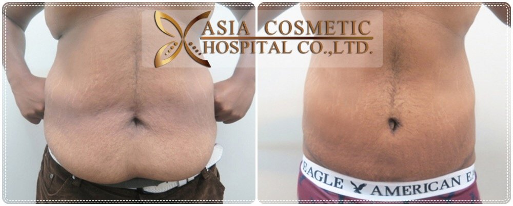 Asia Cosmetic Hospital - Asia Cosmetic Hospital