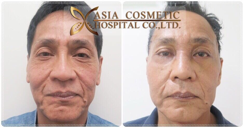 Asia Cosmetic Hospital - Asia Cosmetic Hospital