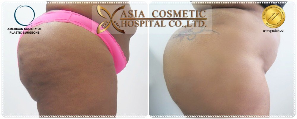 Asia Cosmetic Hospital - Asia Cosmetic Hospital