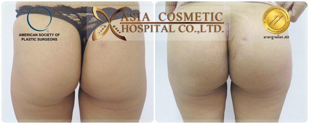 Asia Cosmetic Hospital - Asia Cosmetic Hospital