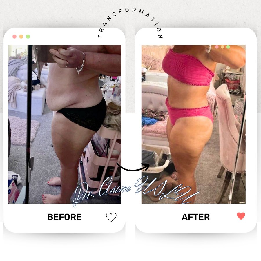 Asım Uslu Plastic Reconstructive and Aesthetic Surgery - Asım Uslu Plastic Reconstructive and Aesthetic Surgery