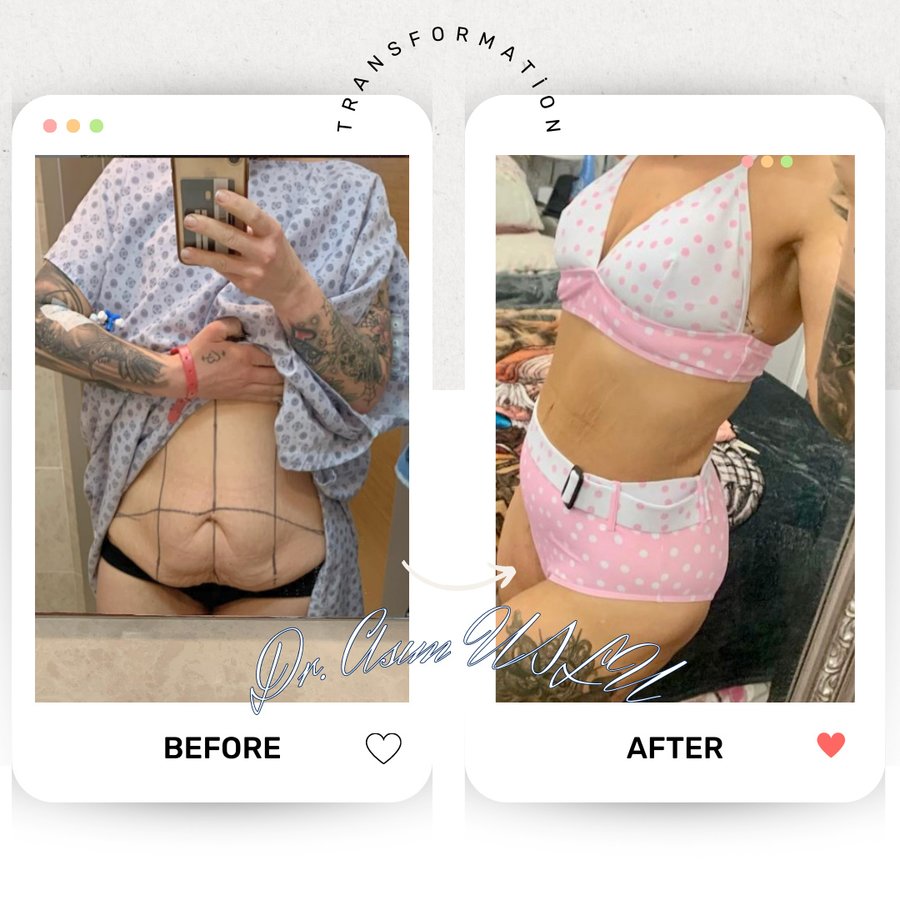 Asım Uslu Plastic Reconstructive and Aesthetic Surgery - Asım Uslu Plastic Reconstructive and Aesthetic Surgery