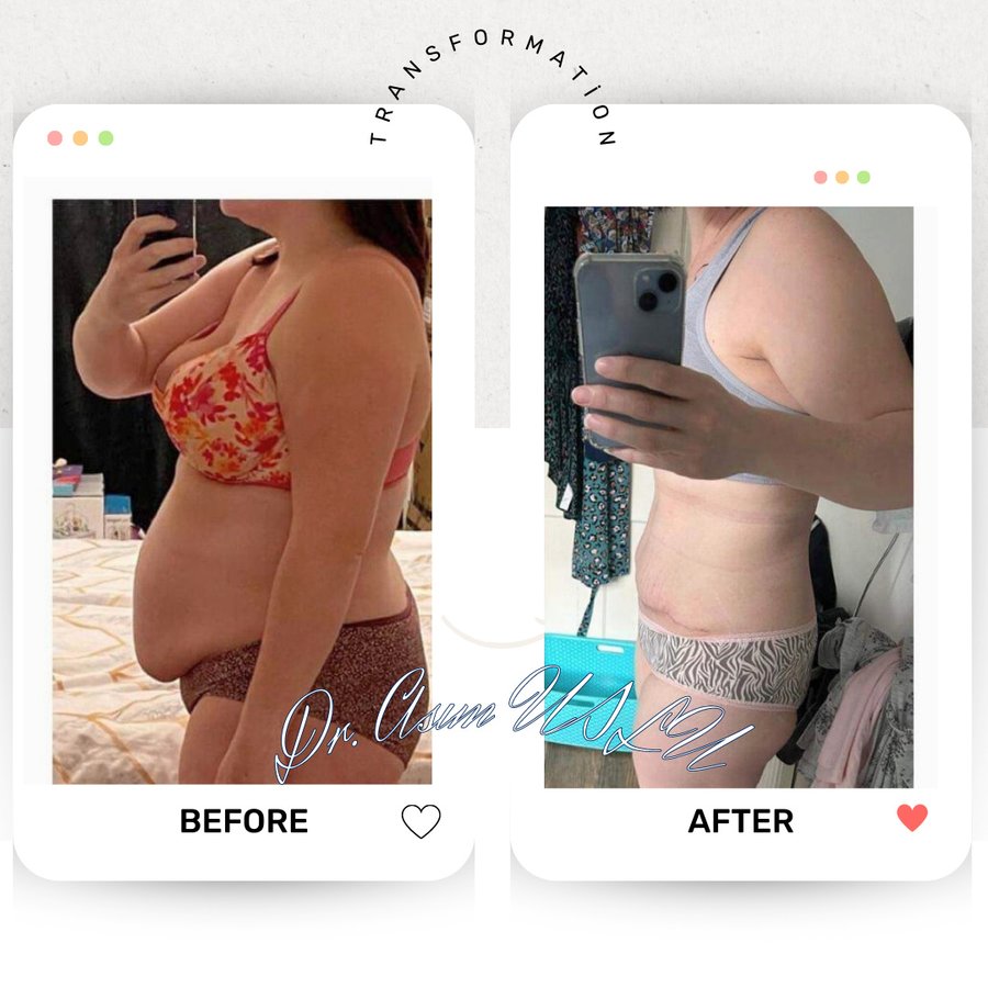 Asım Uslu Plastic Reconstructive and Aesthetic Surgery - Asım Uslu Plastic Reconstructive and Aesthetic Surgery