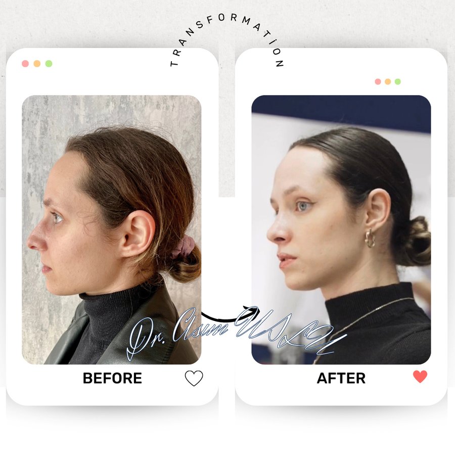 Asım Uslu Plastic Reconstructive and Aesthetic Surgery - Asım Uslu Plastic Reconstructive and Aesthetic Surgery