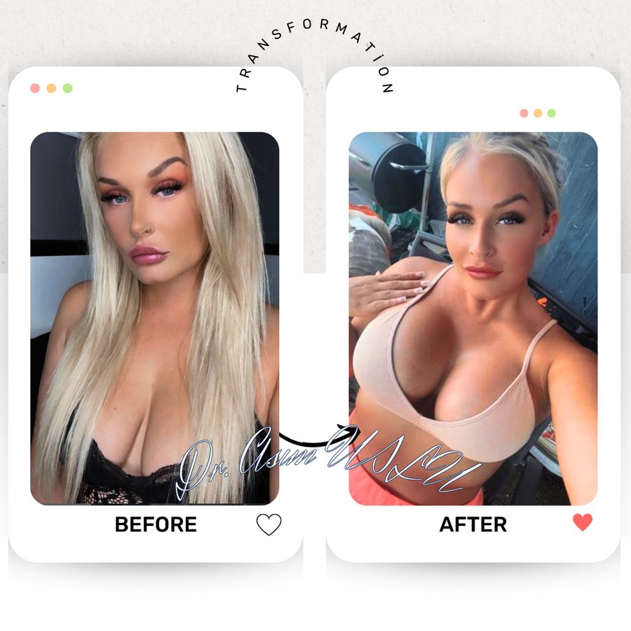 Asım Uslu Plastic Reconstructive and Aesthetic Surgery - Asım Uslu Plastic Reconstructive and Aesthetic Surgery