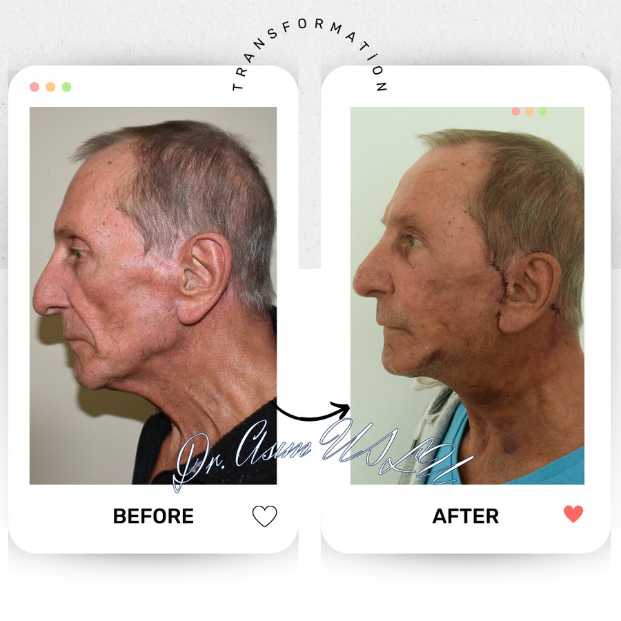 Asım Uslu Plastic Reconstructive and Aesthetic Surgery - Asım Uslu Plastic Reconstructive and Aesthetic Surgery