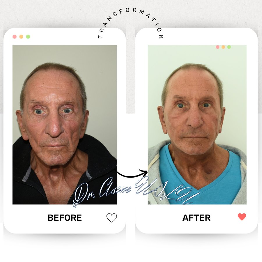 Asım Uslu Plastic Reconstructive and Aesthetic Surgery - Asım Uslu Plastic Reconstructive and Aesthetic Surgery