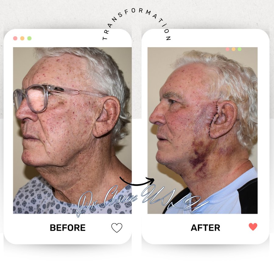 Asım Uslu Plastic Reconstructive and Aesthetic Surgery - Asım Uslu Plastic Reconstructive and Aesthetic Surgery