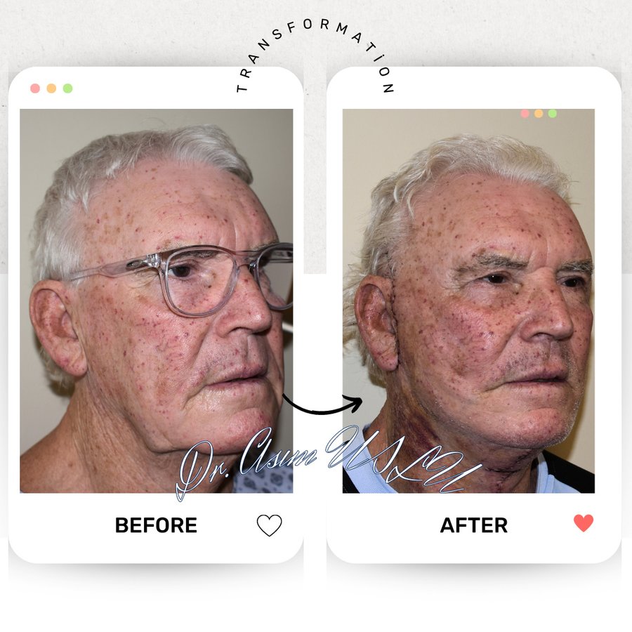 Asım Uslu Plastic Reconstructive and Aesthetic Surgery - Asım Uslu Plastic Reconstructive and Aesthetic Surgery