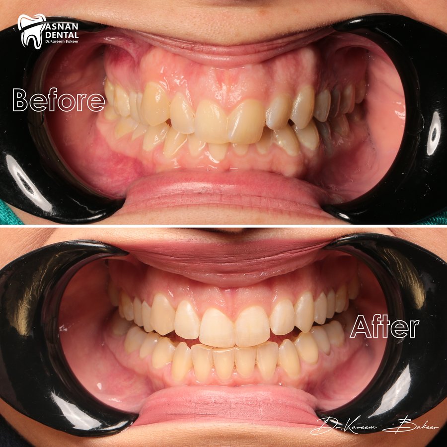 Asnan Dental Center "Dr.K.Bakeer" - Asnan Dental Center "Dr.K.Bakeer"