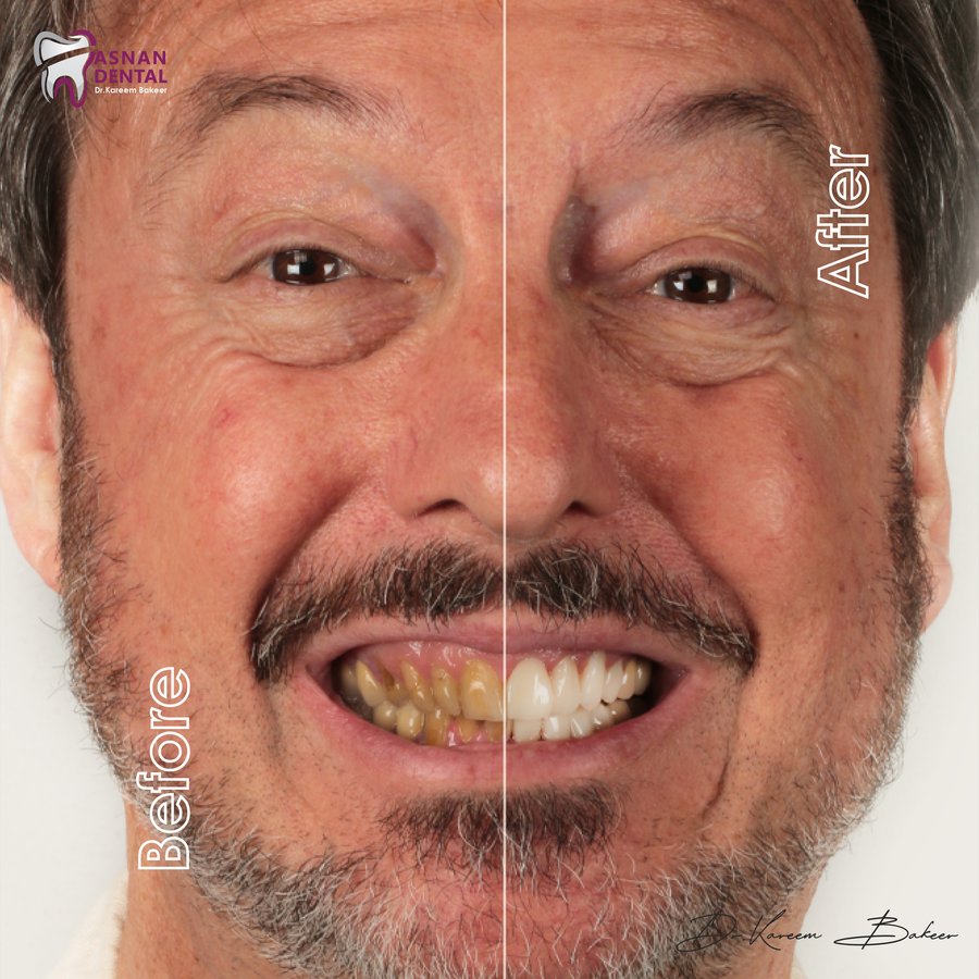 Asnan Dental Center "Dr.K.Bakeer" - Asnan Dental Center "Dr.K.Bakeer"