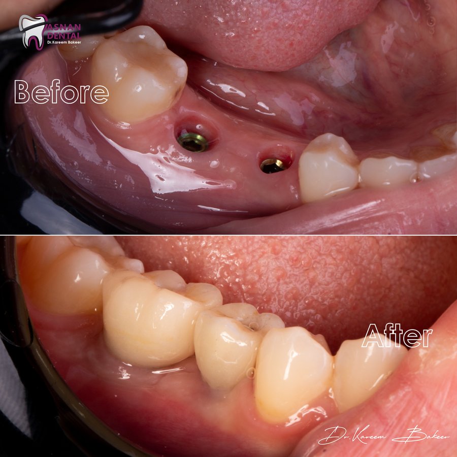 Asnan Dental Center "Dr.K.Bakeer" - Asnan Dental Center "Dr.K.Bakeer"