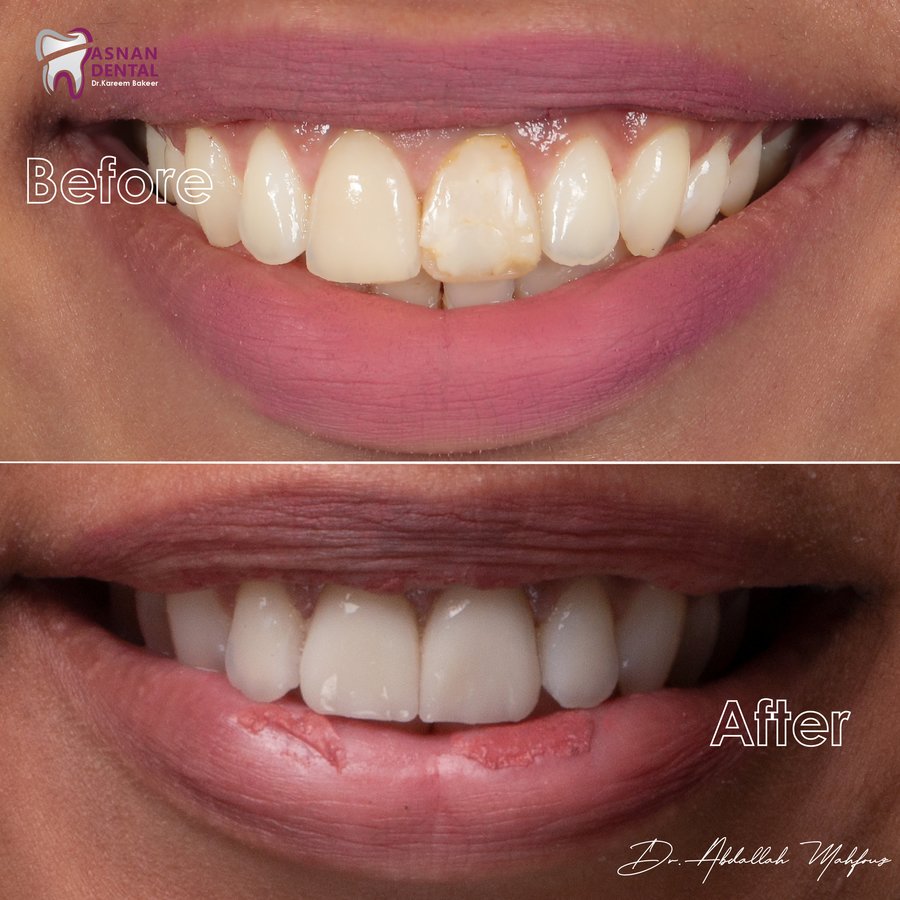 Asnan Dental Center "Dr.K.Bakeer" - Asnan Dental Center "Dr.K.Bakeer"