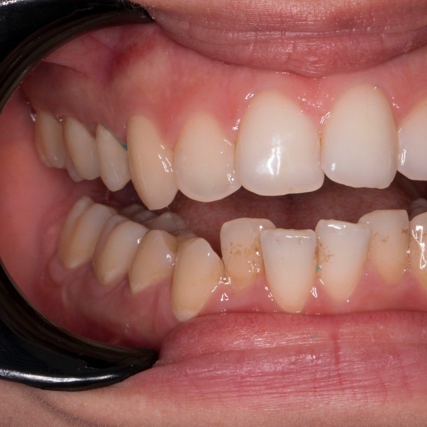 Asnan Dental Center "Dr.K.Bakeer" - Asnan Dental Center "Dr.K.Bakeer"