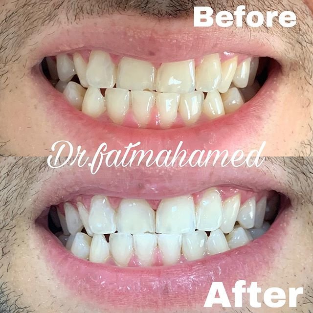 Asnan Lounge - Asnan Lounge