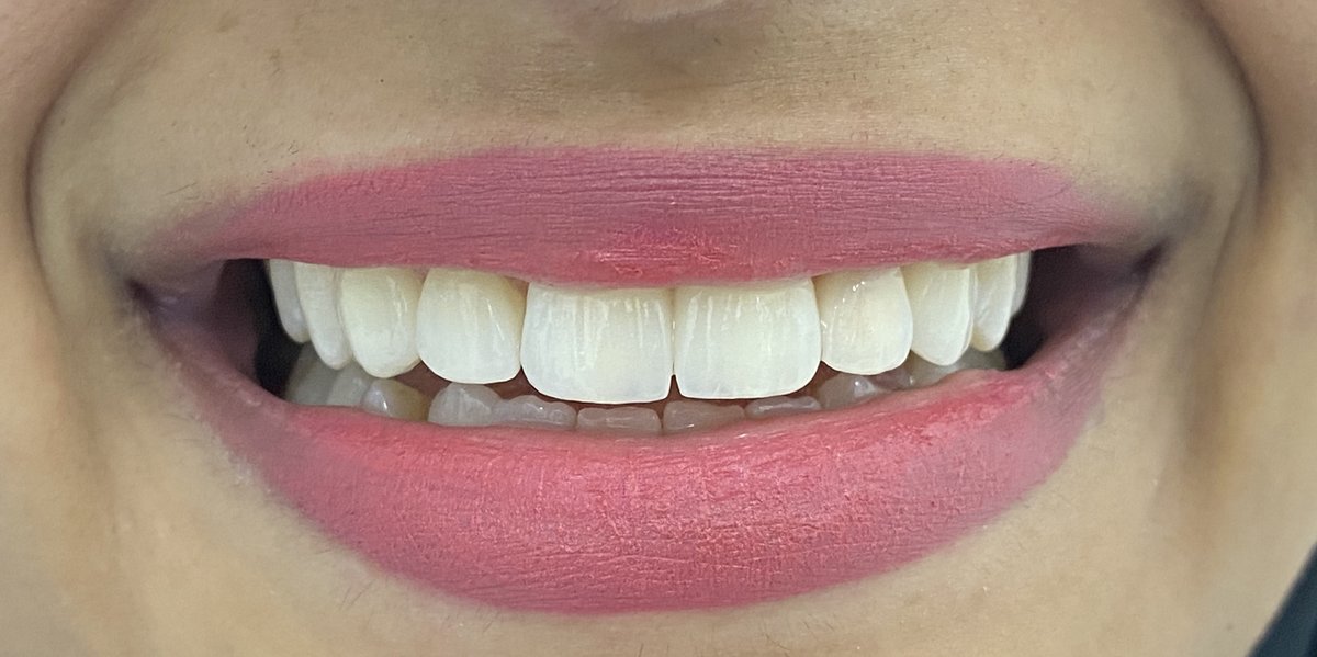 Asnan Lounge - Asnan Lounge