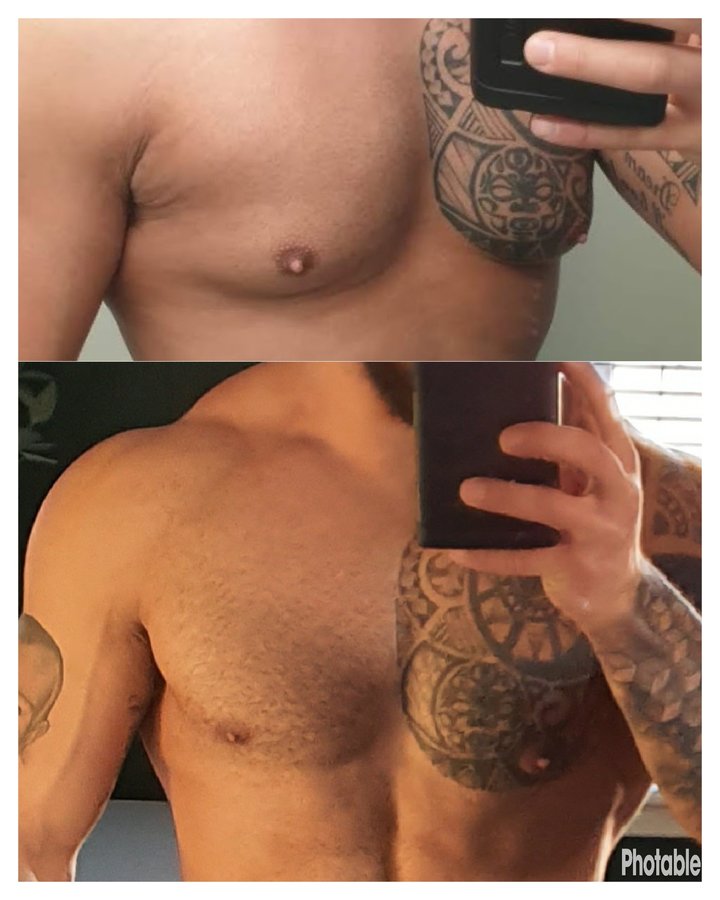 Assoc. Dr. Fatih Uygur / Plastic Reconstructive and Aesthetic Clinic - Assoc. Dr. Fatih Uygur / Plastic Reconstructive and Aesthetic Clinic