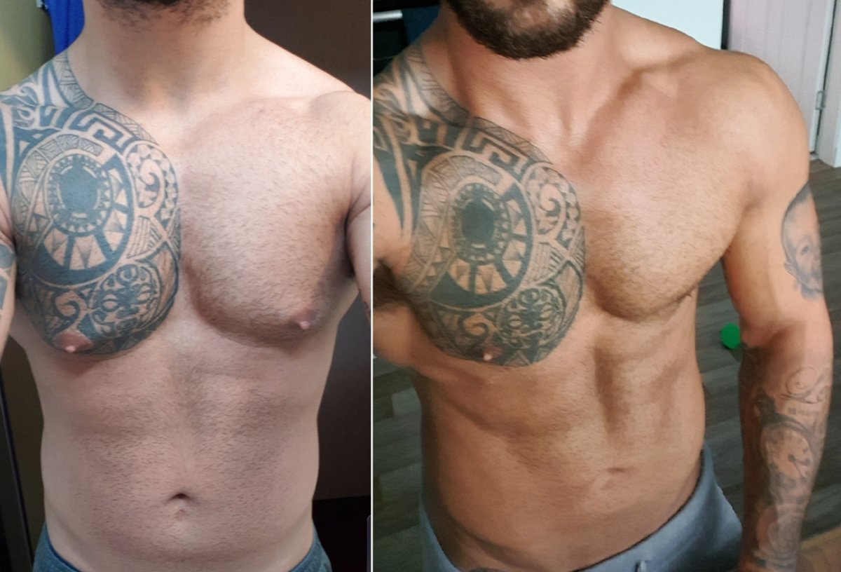 Assoc. Dr. Fatih Uygur / Plastic Reconstructive and Aesthetic Clinic - Assoc. Dr. Fatih Uygur / Plastic Reconstructive and Aesthetic Clinic