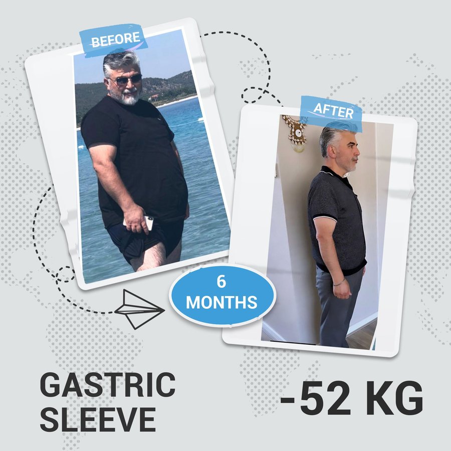 Assoc. Dr. Hasan Abuoğlu - Assoc. Dr. Hasan Abuoğlu