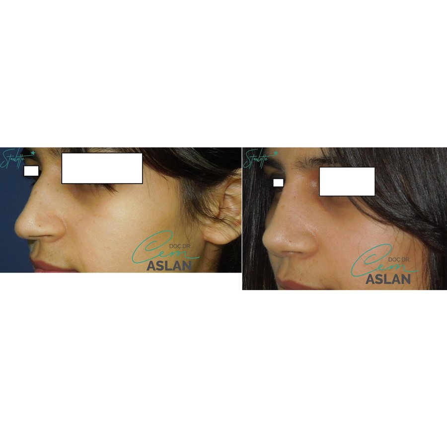 Assoc. Prof. Dr Cem Aslan Clinic - Assoc. Prof. Dr Cem Aslan Clinic