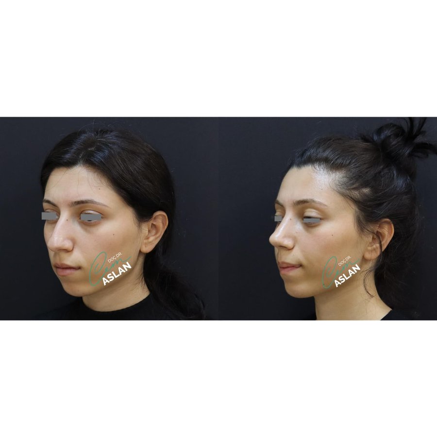 Assoc. Prof. Dr Cem Aslan Clinic - Assoc. Prof. Dr Cem Aslan Clinic