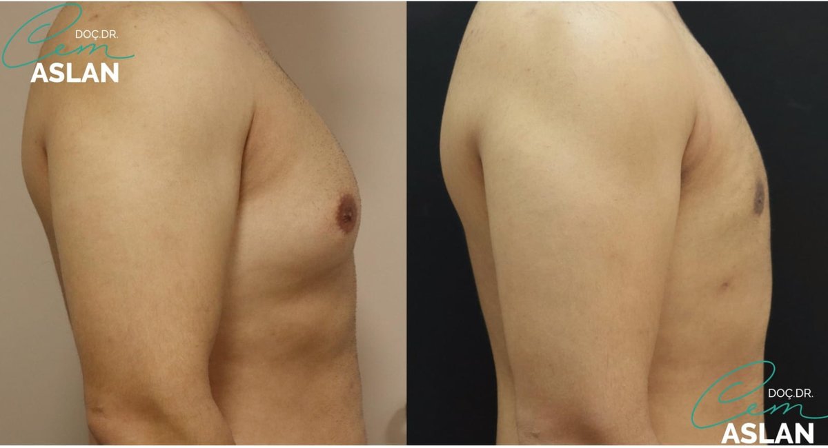 Assoc. Prof. Dr Cem Aslan Clinic - Assoc. Prof. Dr Cem Aslan Clinic