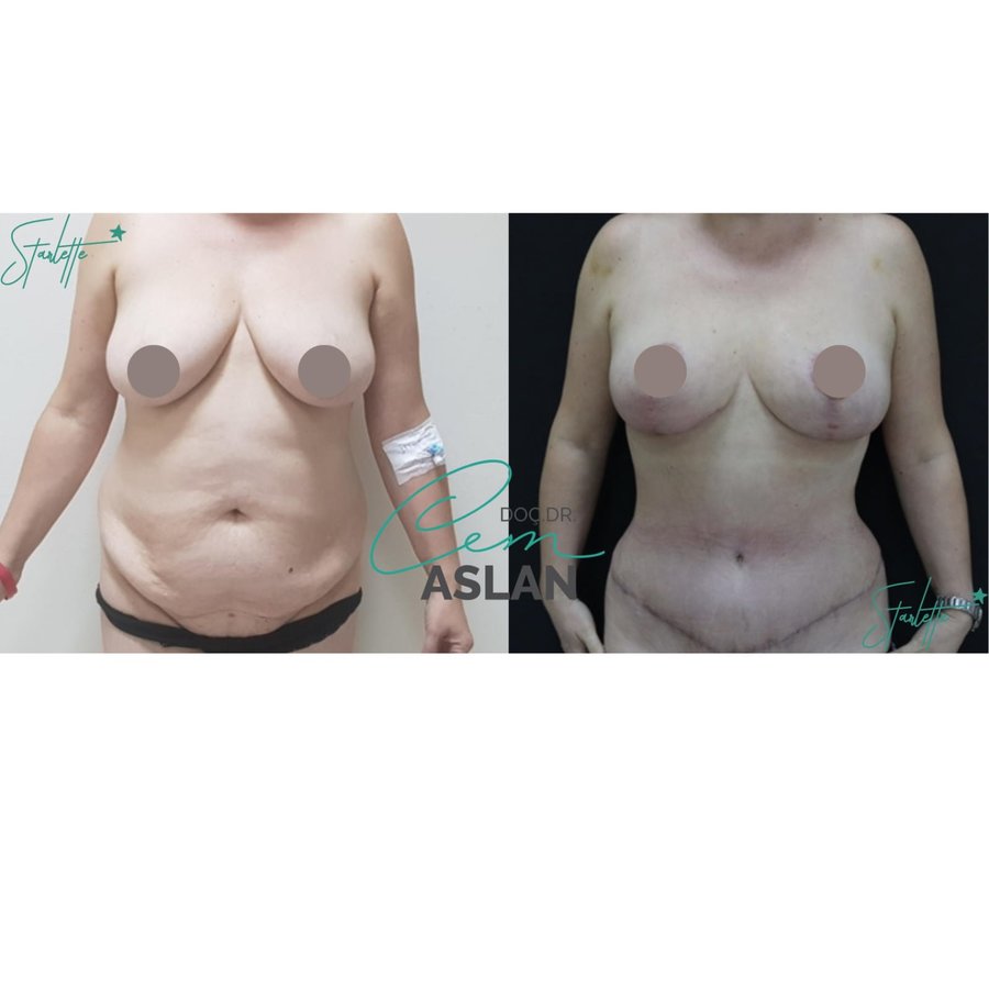 Assoc. Prof. Dr Cem Aslan Clinic - Assoc. Prof. Dr Cem Aslan Clinic