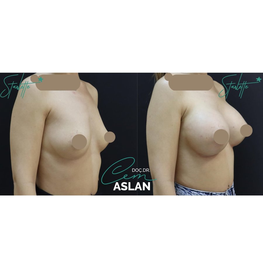 Assoc. Prof. Dr Cem Aslan Clinic - Assoc. Prof. Dr Cem Aslan Clinic