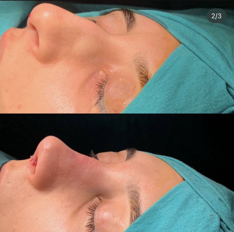 Assoc. Prof. Dr. H. Baki Yilmaz - Assoc. Prof. Dr. H. Baki Yilmaz