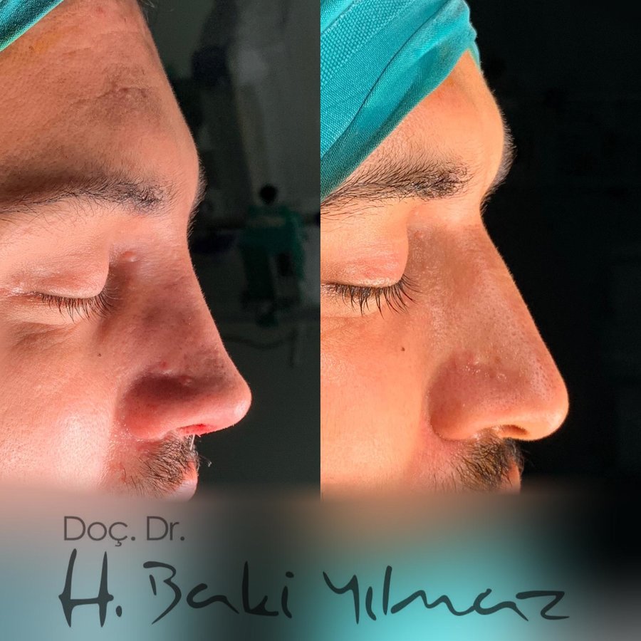 Assoc. Prof. Dr. H. Baki Yilmaz - Assoc. Prof. Dr. H. Baki Yilmaz