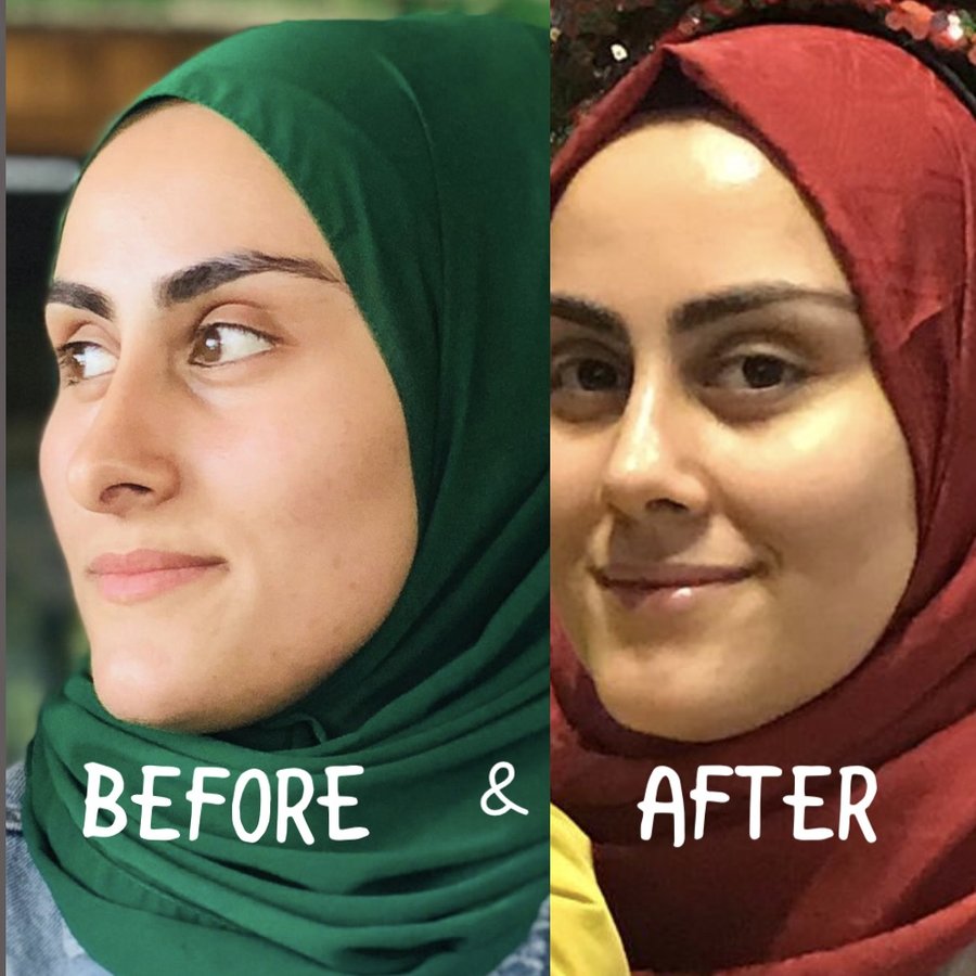 Assoc. Prof. Dr. H. Baki Yilmaz - Assoc. Prof. Dr. H. Baki Yilmaz