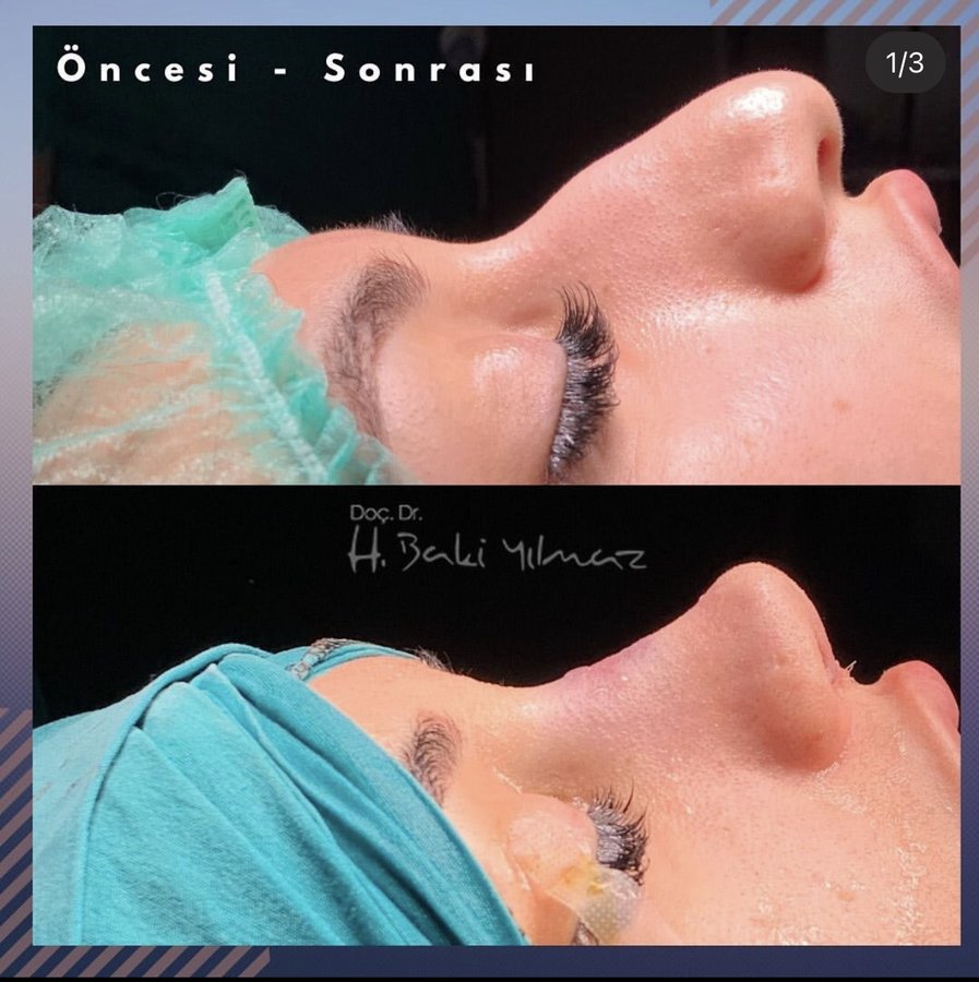 Assoc. Prof. Dr. H. Baki Yilmaz - Assoc. Prof. Dr. H. Baki Yilmaz