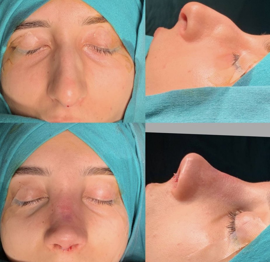 Assoc. Prof. Dr. H. Baki Yilmaz - Assoc. Prof. Dr. H. Baki Yilmaz