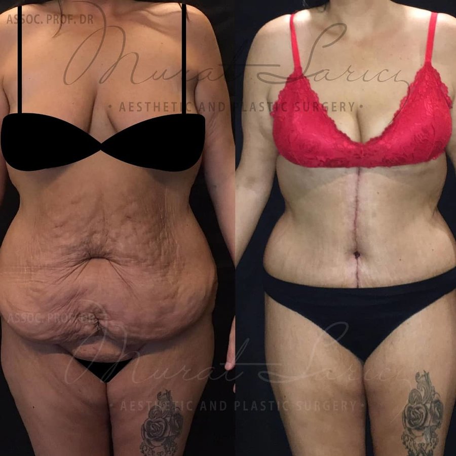 Assoc. Prof. Murat Sarıcı - Assoc. Prof. Murat Sarıcı