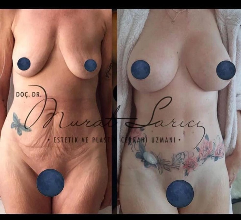 Assoc. Prof. Murat Sarıcı - Assoc. Prof. Murat Sarıcı