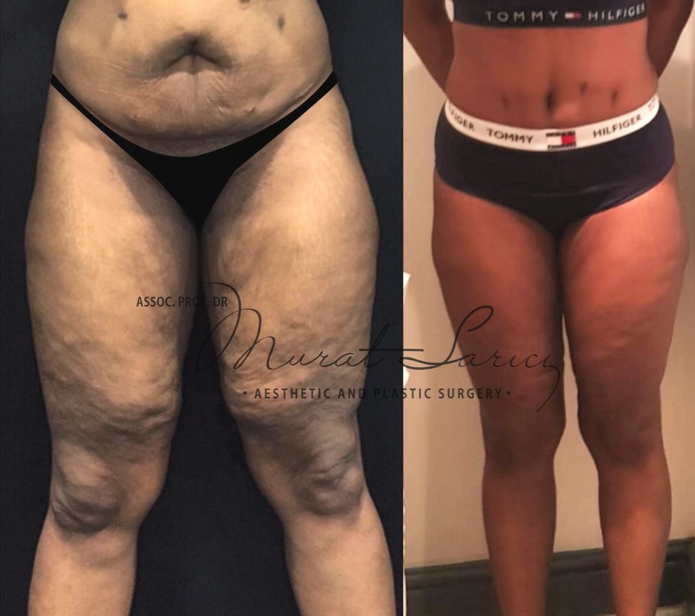 Assoc. Prof. Murat Sarıcı - Assoc. Prof. Murat Sarıcı