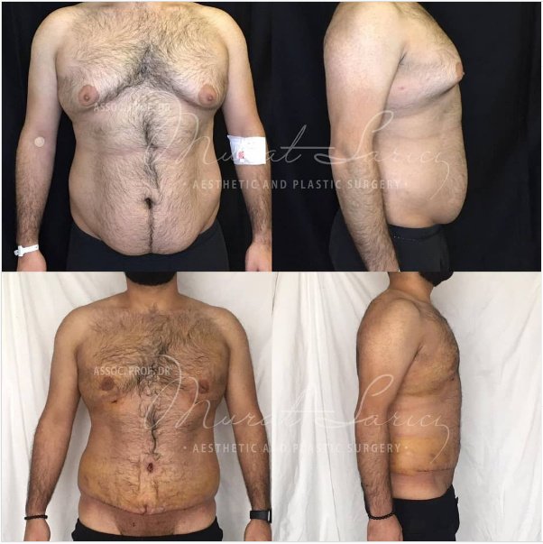 Assoc. Prof. Murat Sarıcı - Assoc. Prof. Murat Sarıcı