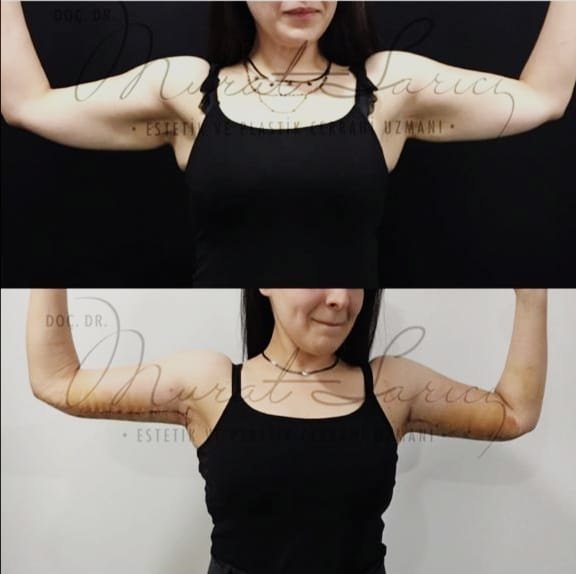 Assoc. Prof. Murat Sarıcı - Assoc. Prof. Murat Sarıcı